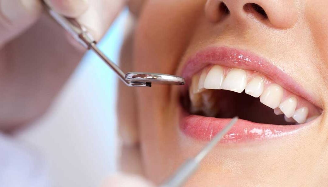 Cosmetic Dentistry in Tijuana