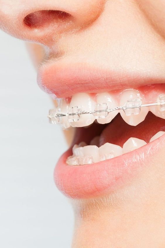 Orthodontics Orthodontics