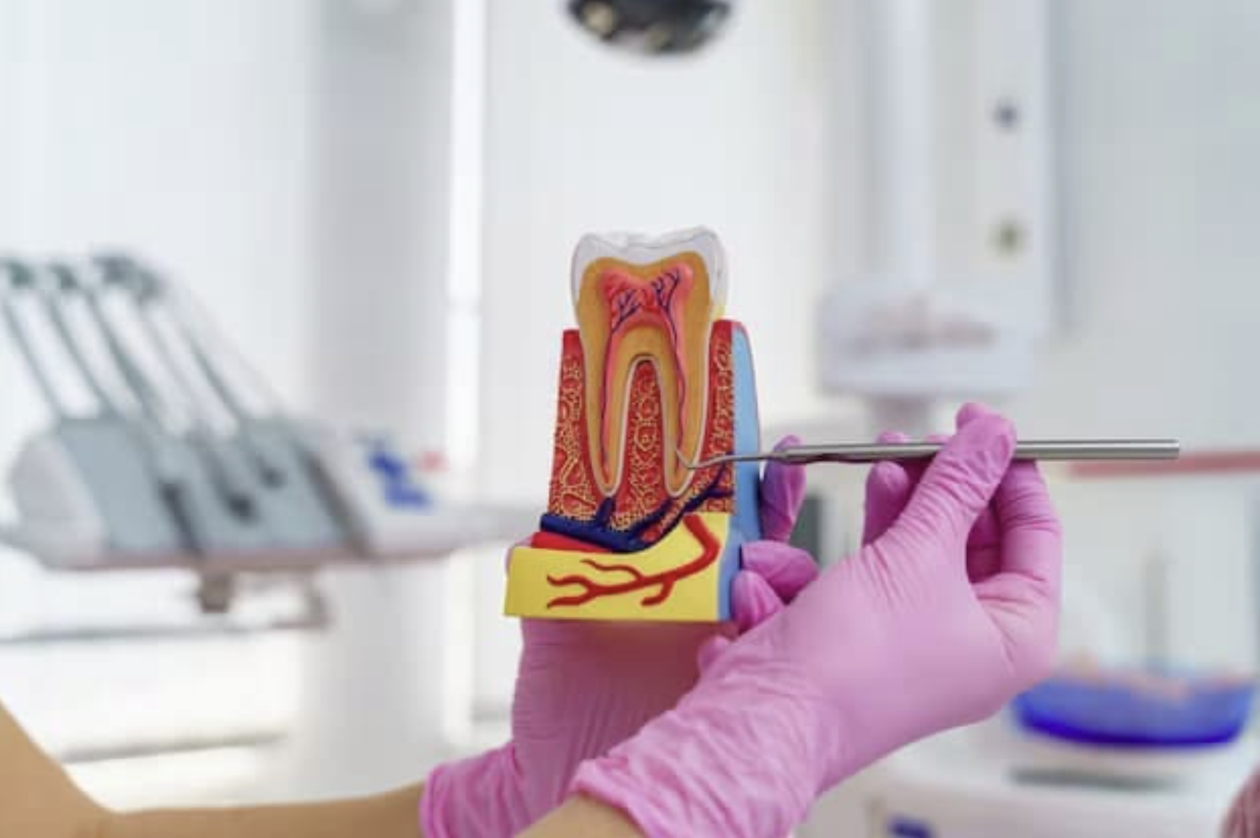 Root Canal Treatment Root Canal Treatment